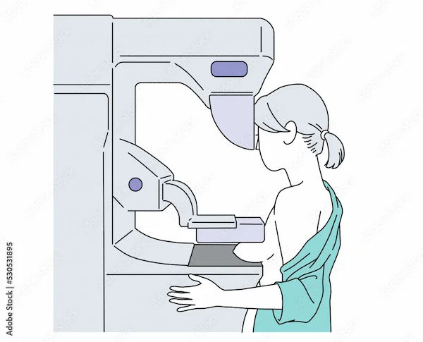 Breast Calcifications: Types, Causes and Treatment